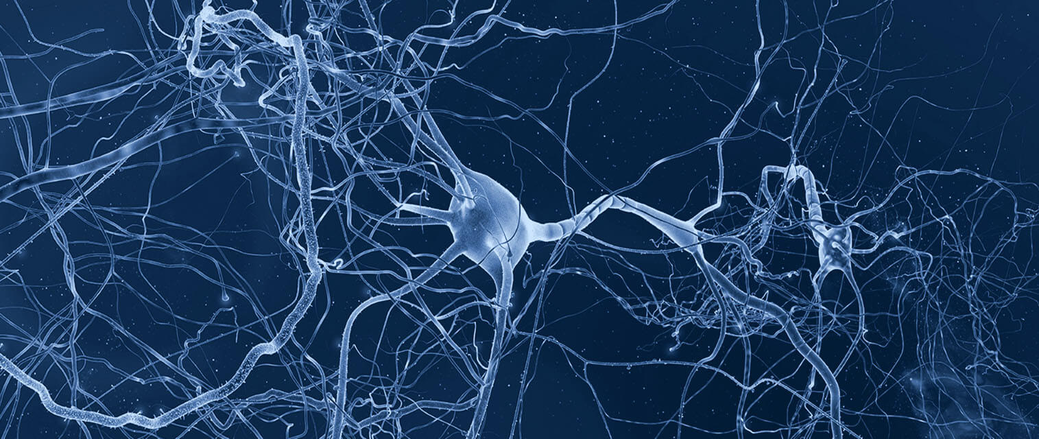 Умершие клетки мозга. Нейроны мозга. Клетки головного мозга. Мозг человека Нейроны. Нейронная сеть мозга.
